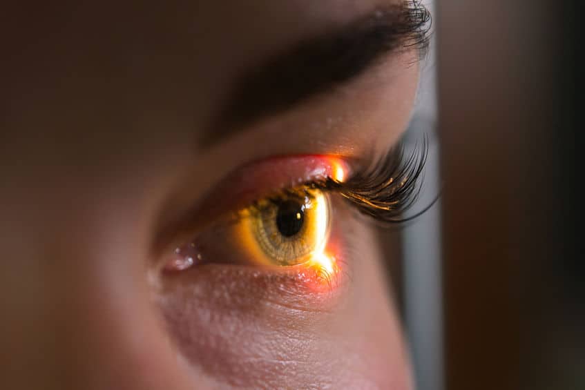 close up of an eye during an eye exam